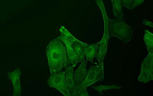 根據(jù)染料的激發(fā)和發(fā)射光譜怎么確定顯微鏡的激發(fā)光