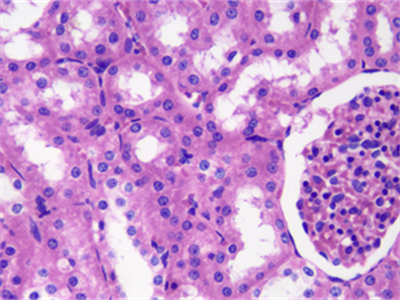 TS-20190404182027536