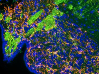 明慧電動倒置熒光附件應(yīng)用效果圖 (1)