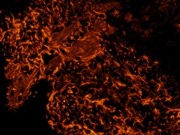 明慧電動倒置熒光附件應(yīng)用效果圖 (4)