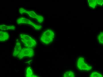 明慧電動倒置熒光附件應(yīng)用效果圖 (3)
