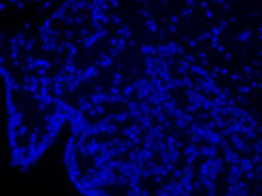 明慧電動倒置熒光附件應(yīng)用效果圖 (6)