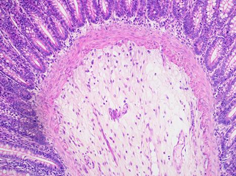 觀察方式-明場(chǎng)