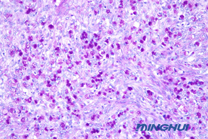 生物顯微鏡NE710+ MHD2000用于醫(yī)院病理檢驗(yàn)2.jpg