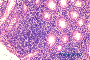 生物顯微鏡NE710+ MHD2000用于醫(yī)院病理檢驗(yàn)3.jpg