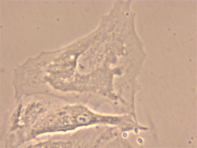 明慧NIB610倒置顯微鏡應用于細胞培養(yǎng)觀察 明慧NIB610倒置顯微鏡應用于細胞培養(yǎng)觀察