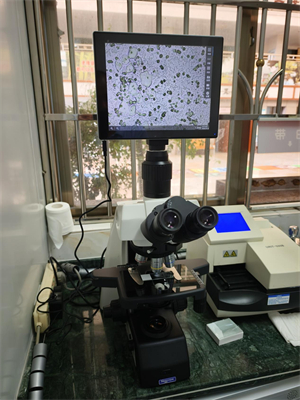 廣州明慧公司的研究級正置生物顯微鏡NE910助力廣東河源的一家醫(yī)院婦科檢驗(yàn)科室，用于白帶檢測。2.jpg