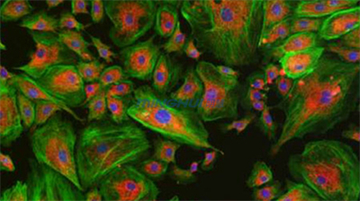 倒置熒光顯微鏡MHIF2000-熒光1.jpg 倒置熒光顯微鏡MHIF2000-熒光1.jpg