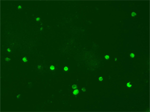 NE910-FL科研級(jí)正置熒光顯微鏡應(yīng)用于廣州醫(yī)科大學(xué)